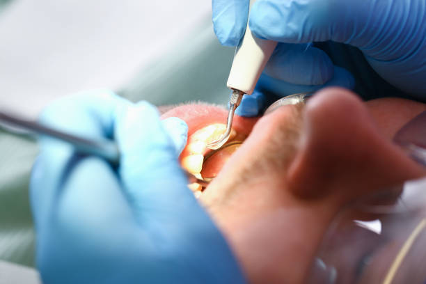 Best Emergency TMJ Treatment in Spencerport, NY