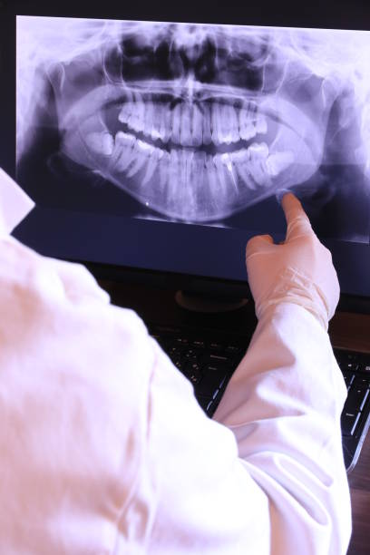 Best Emergency Gum Treatment in Spencerport, NY