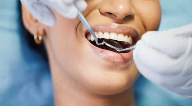 Best Pediatric Emergency Dentist in Spencerport, NY